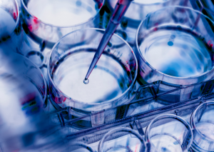 arthritis research trials